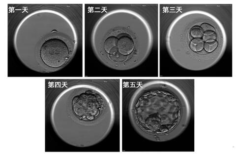 试管移植专家眼中，什么样的胚胎才叫“好胚胎”？